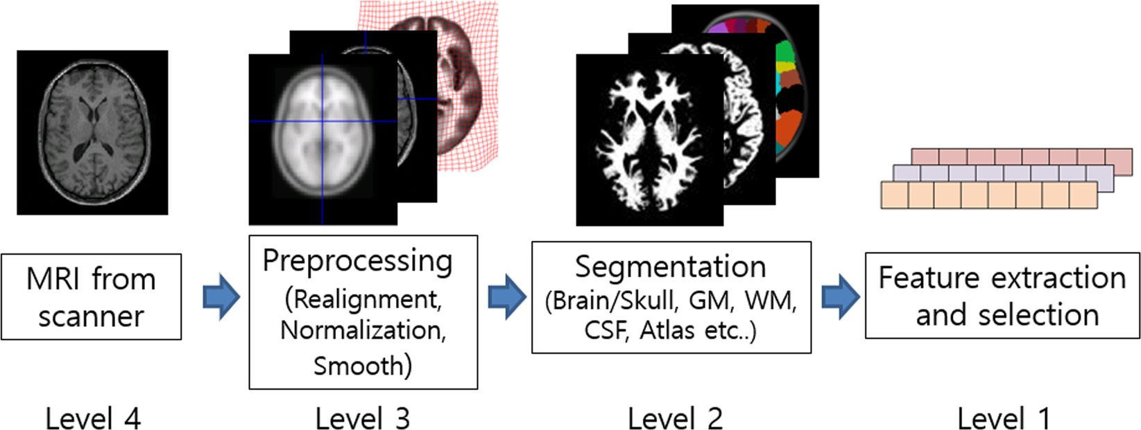 Brain Disease Classification